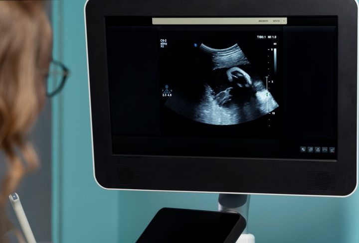 3D Scan in Pregnancy